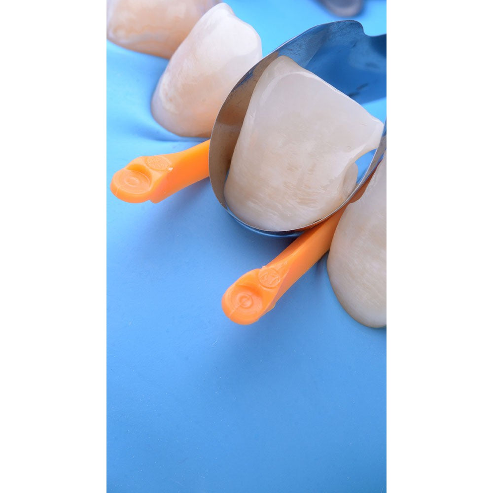 Polydentia Unica Anterior Matrix Intro Kit