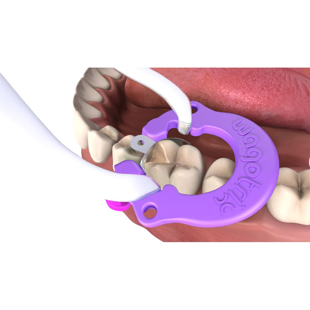 WagoTrix Plastic Single-Use Matrix Rings