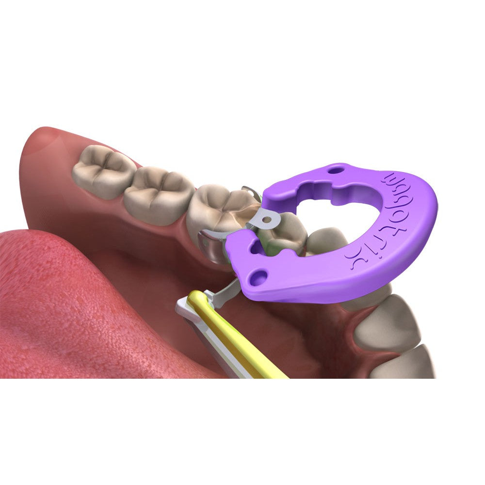 WagoTrix Plastic Single-Use Matrix Rings