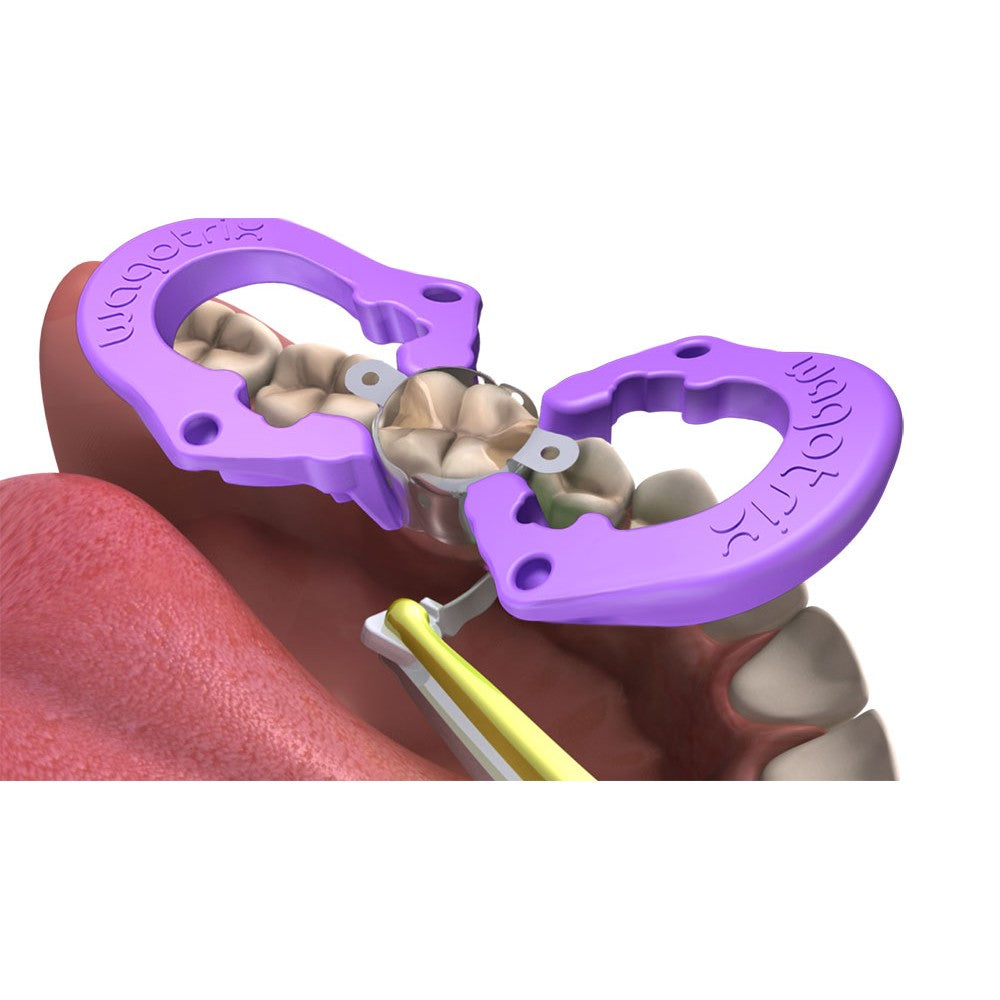 WagoTrix Plastic Single-Use Matrix Rings